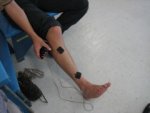 Functional Electrical Stimulation in Standing to Treat Decreased